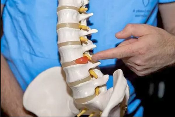 Medicul Martin explică tratamentul acasă pentru artrită și dureri de spate