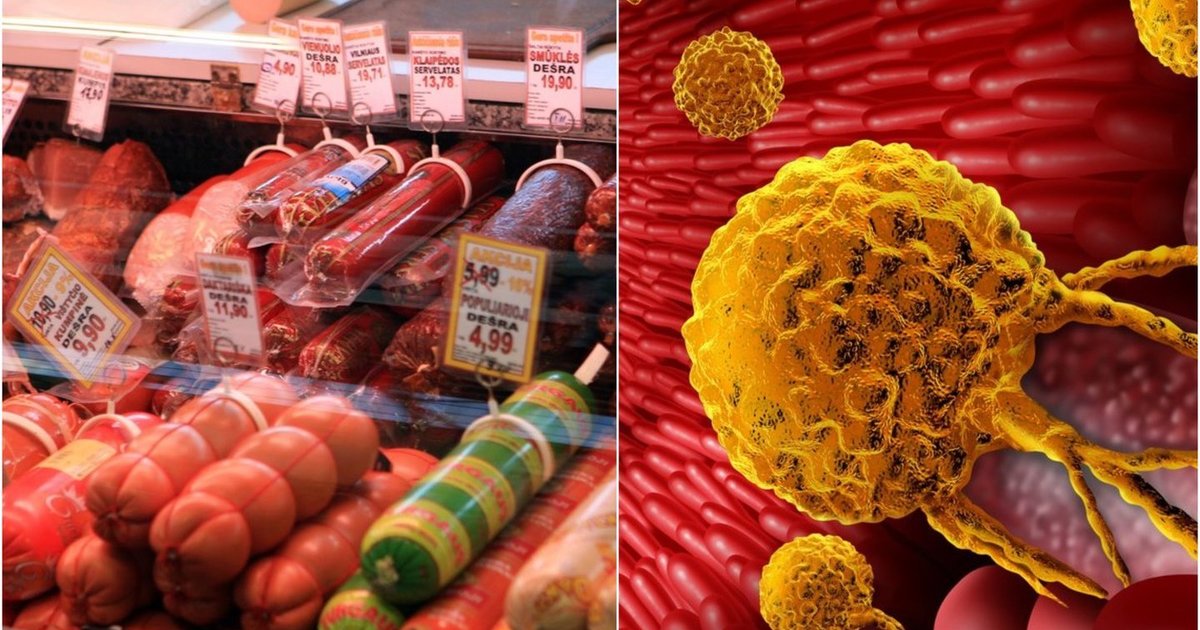 Vėžio rizikos veiksniai: infekcijos, alkoholis ir perdirbta mėsa