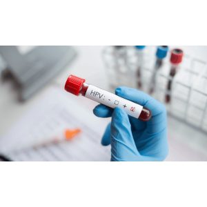 HPV la bărbați: 1 din 5 poartă un tip care poate provoca cancer